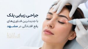 جراحی زیبایی پلک با جدیدترین فناوری‌های رفع افتادگی در مشهد