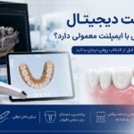 مقایسه ایمپلنت دیجیتال و معمولی