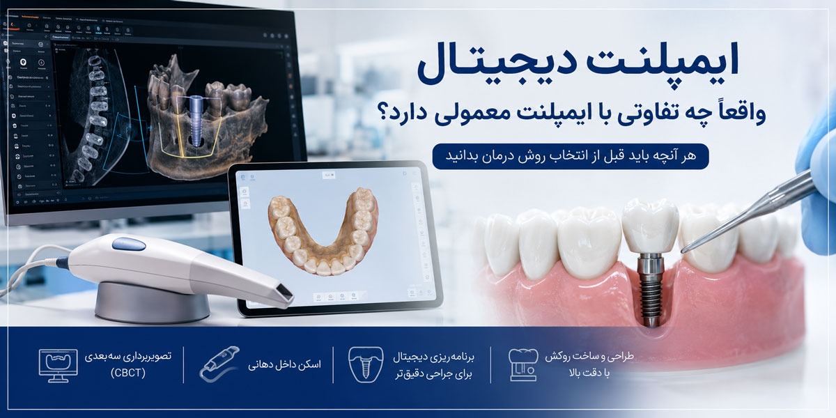 ایمپلنت دیجیتال؛ یک تحول واقعی یا فقط یک نام جدید؟